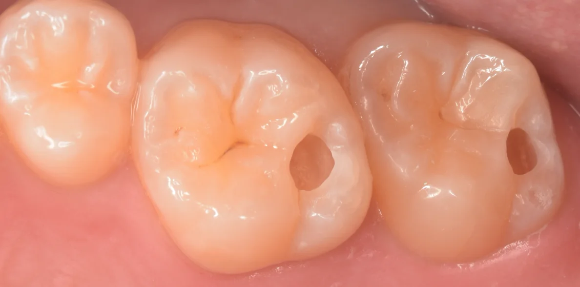 群馬からお越しの歯科医師の方。|坂寄歯科医院(取手市藤代) - 画像3