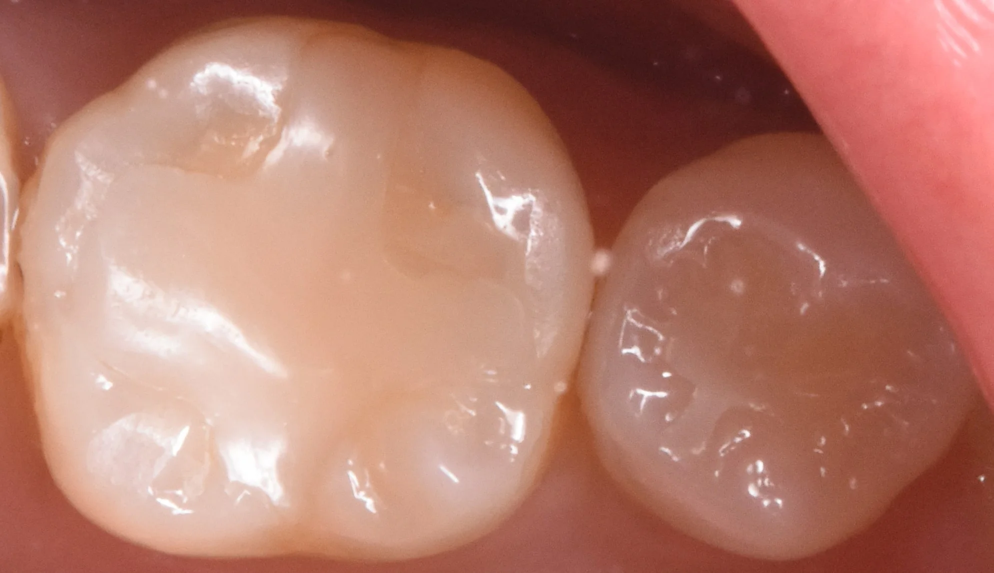 ブログ・お役立ち情報｜坂寄歯科医院（取手市藤代）