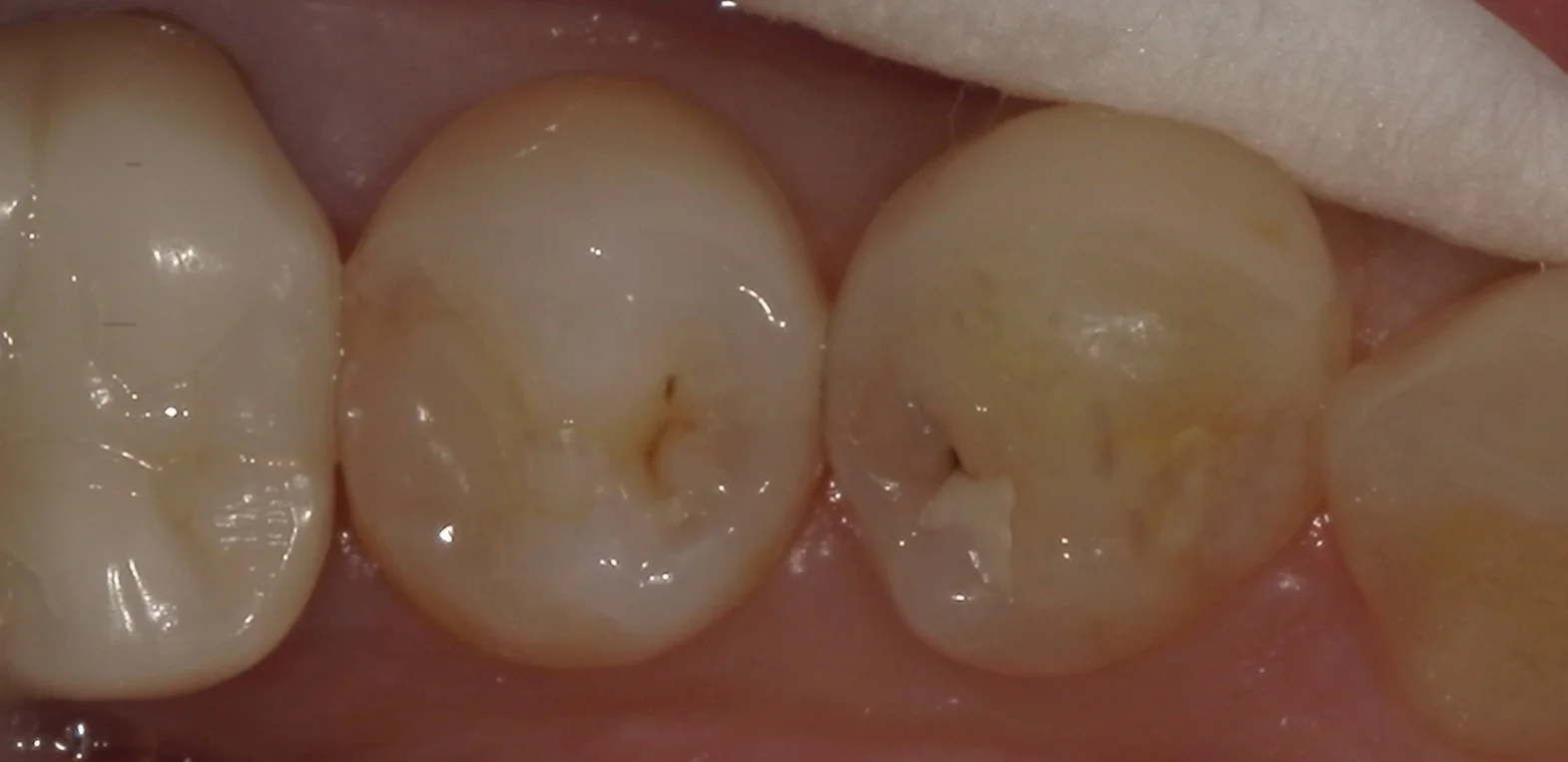 ブログ・お役立ち情報｜坂寄歯科医院（取手市藤代）