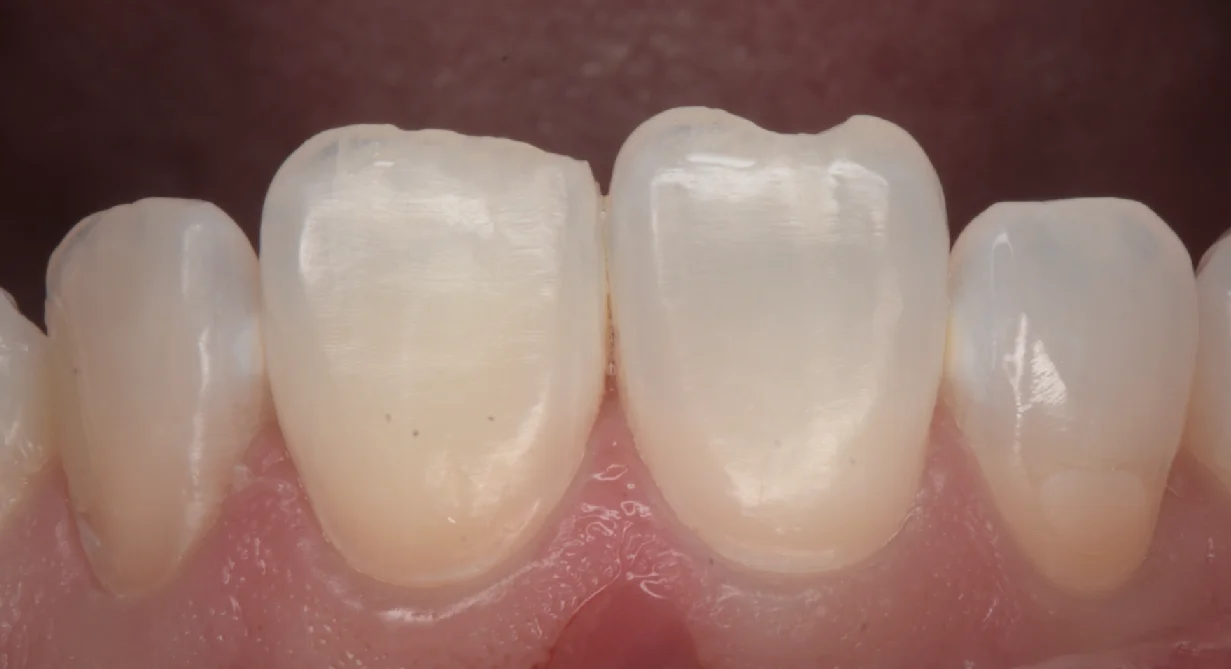 ブログ・お役立ち情報｜坂寄歯科医院（取手市藤代）