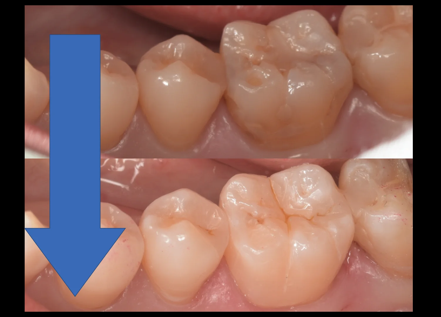 三鷹より来院された方｜坂寄歯科医院（取手市藤代） - 画像10