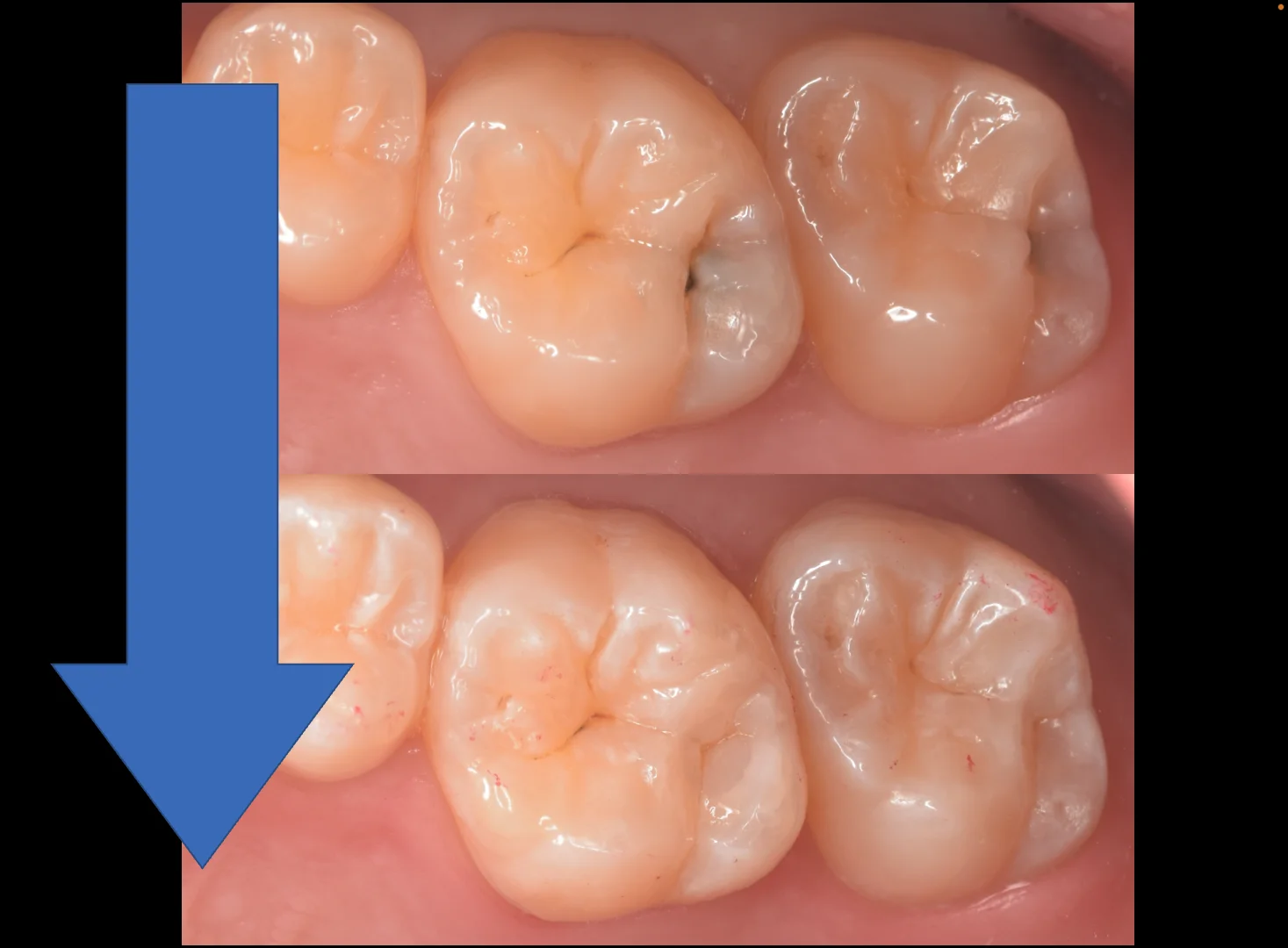 群馬からお越しの歯科医師の方。|坂寄歯科医院(取手市藤代) - 画像5