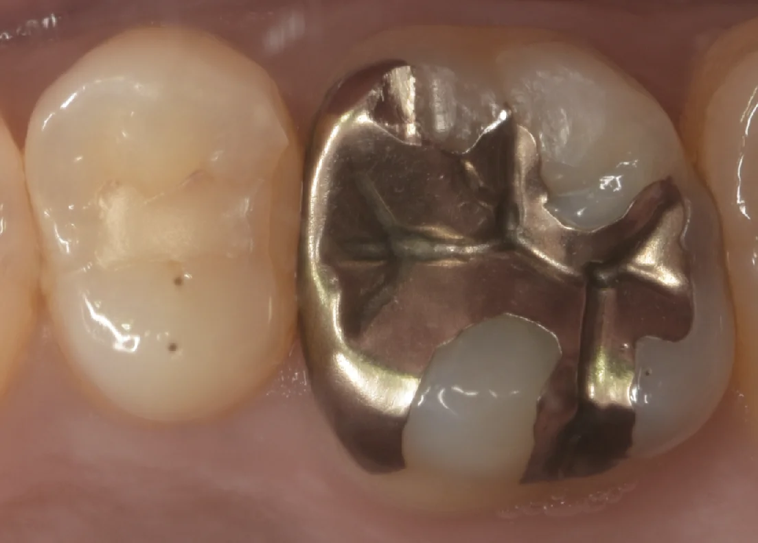 ブログ・お役立ち情報｜坂寄歯科医院（取手市藤代）