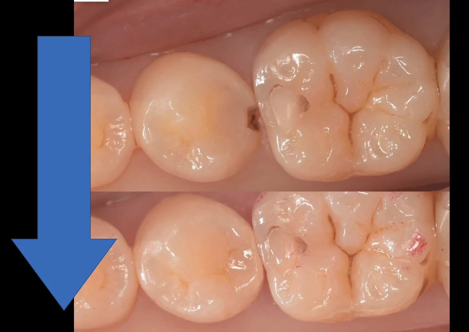 東京都内よりお越しの方をダイレクトで。｜坂寄歯科医院（取手市藤代） - 画像5