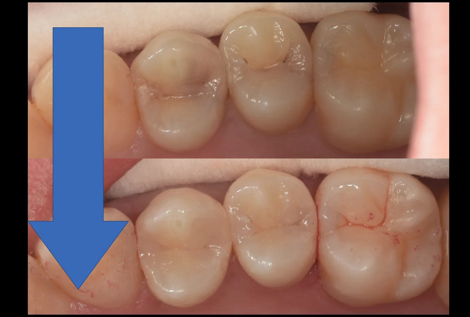 通常の保険診療。|坂寄歯科医院(取手市藤代) - 画像5