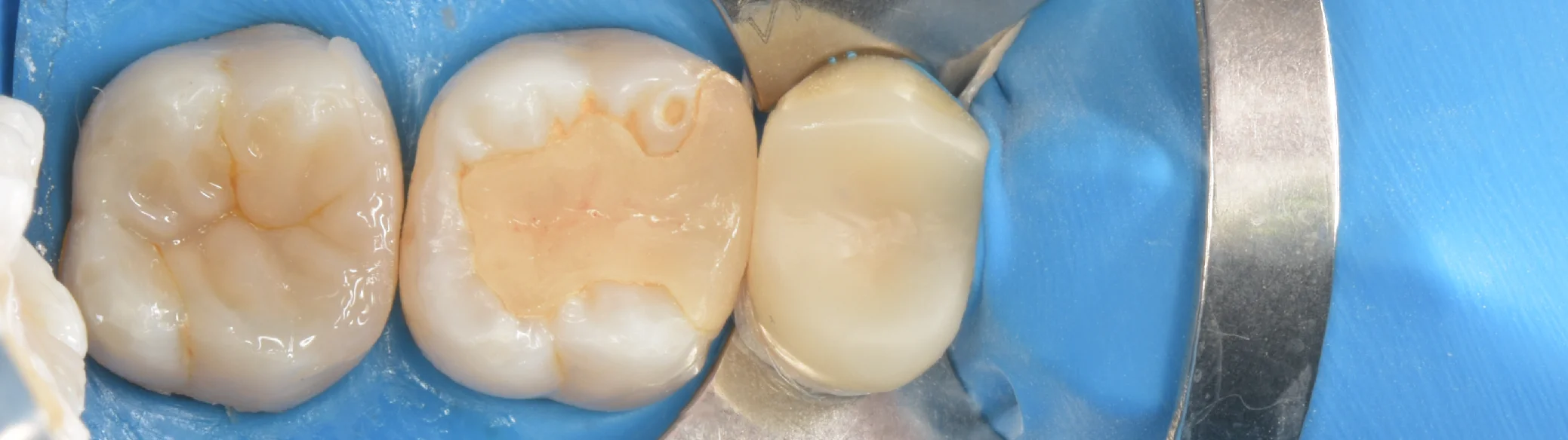 足立区からお越しの方。｜坂寄歯科医院（取手市藤代） - 画像6