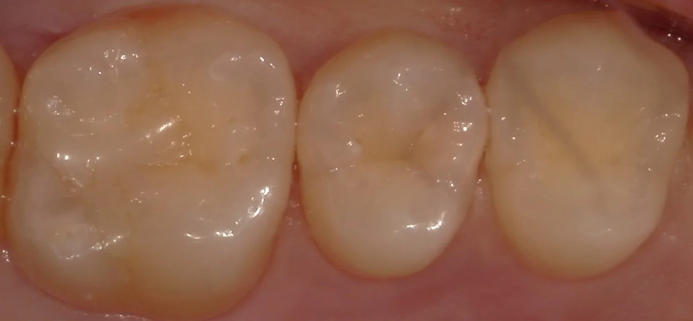 ブログ・お役立ち情報｜坂寄歯科医院（取手市藤代）