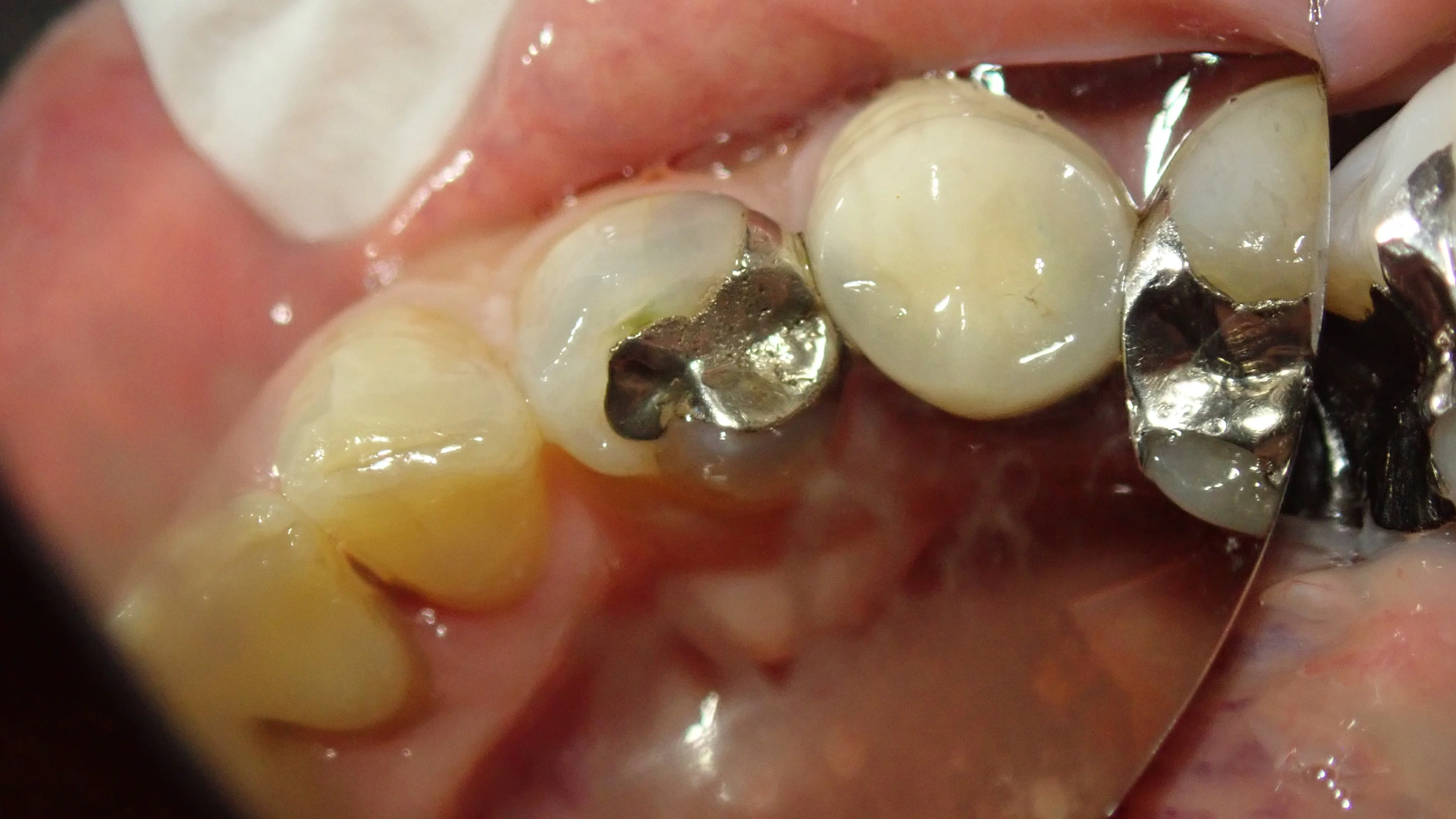 ブログ・お役立ち情報｜坂寄歯科医院（取手市藤代）