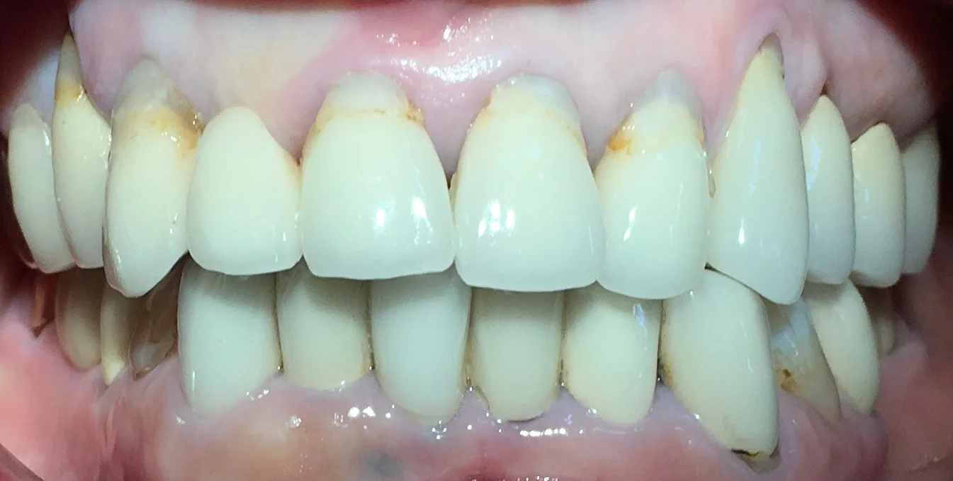 ブログ・お役立ち情報｜坂寄歯科医院（取手市藤代）