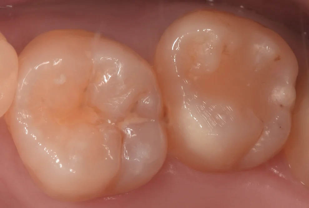 ブログ・お役立ち情報｜坂寄歯科医院（取手市藤代）