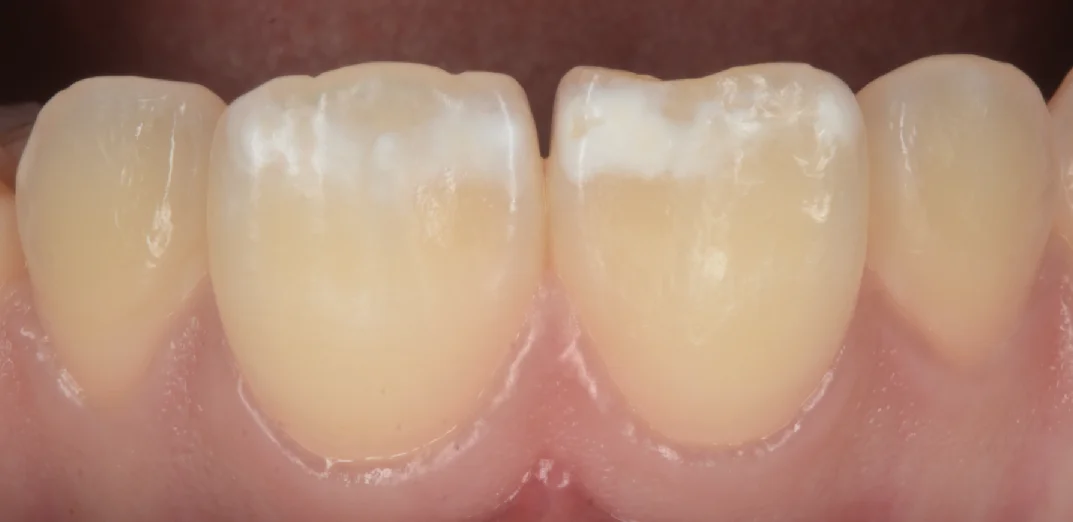 ブログ・お役立ち情報｜坂寄歯科医院（取手市藤代）