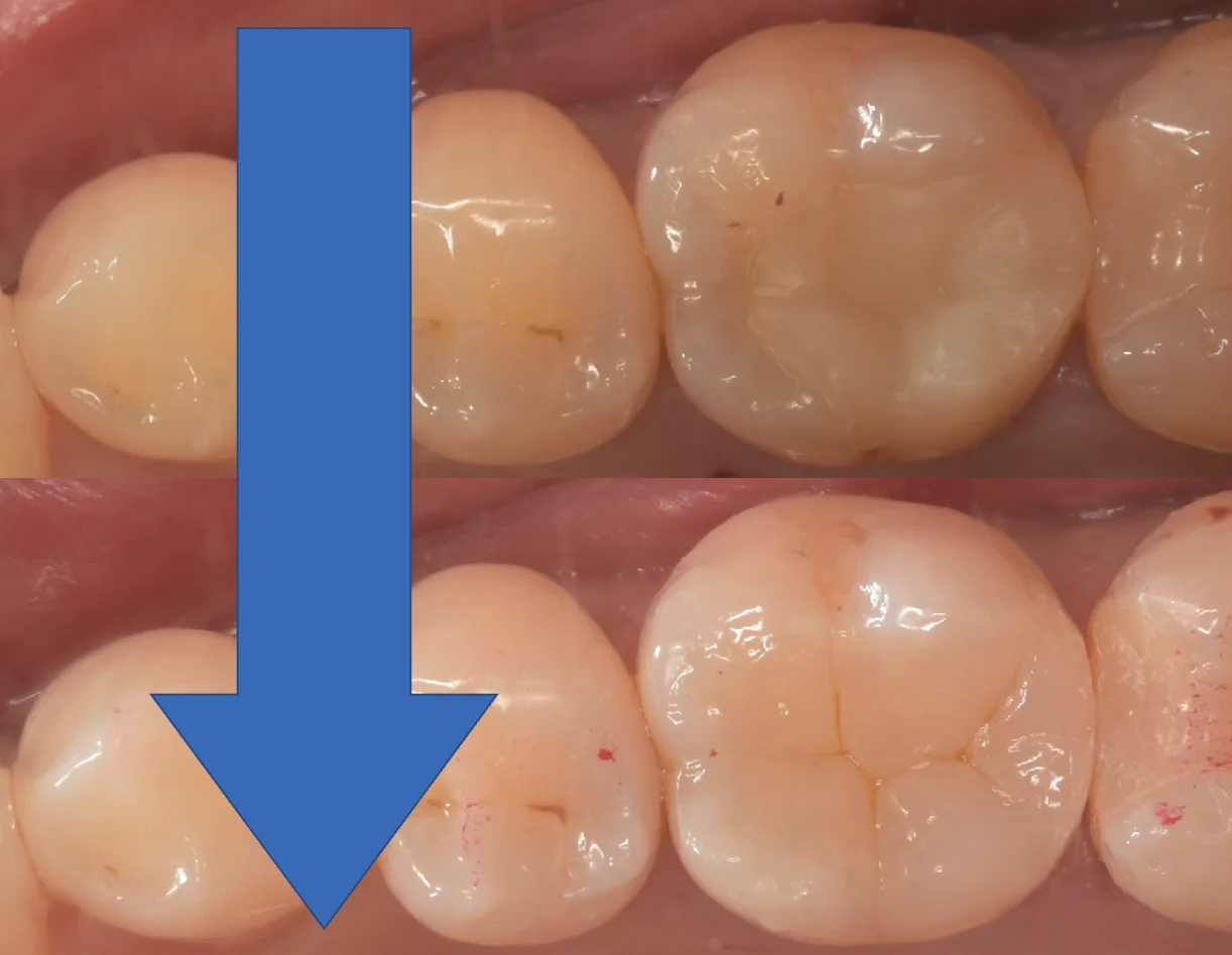 埼玉県からお越しの方|坂寄歯科医院(取手市藤代) - 画像4