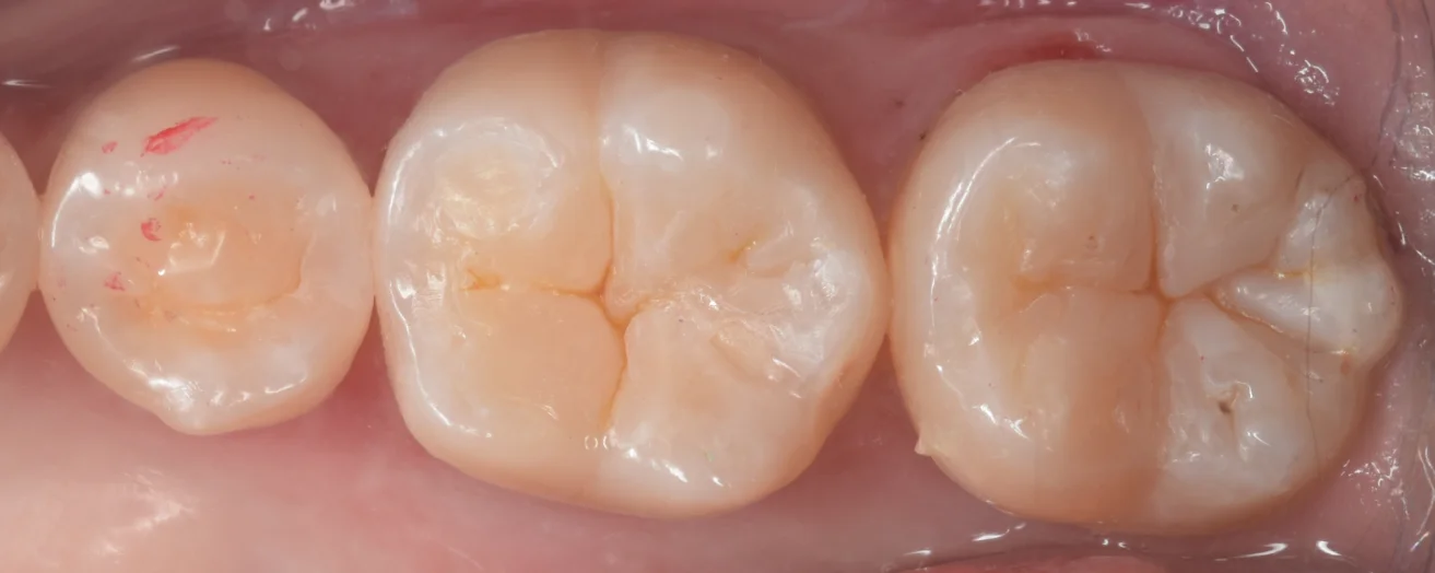 遠方からいらっしゃった歯科医師の方。|坂寄歯科医院(取手市藤代) - 画像4