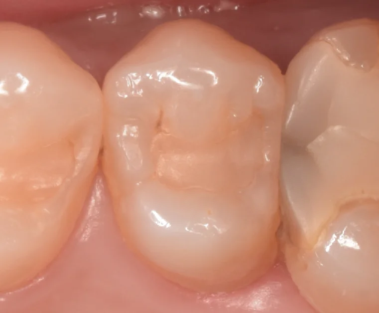 ブログ・お役立ち情報｜坂寄歯科医院（取手市藤代）