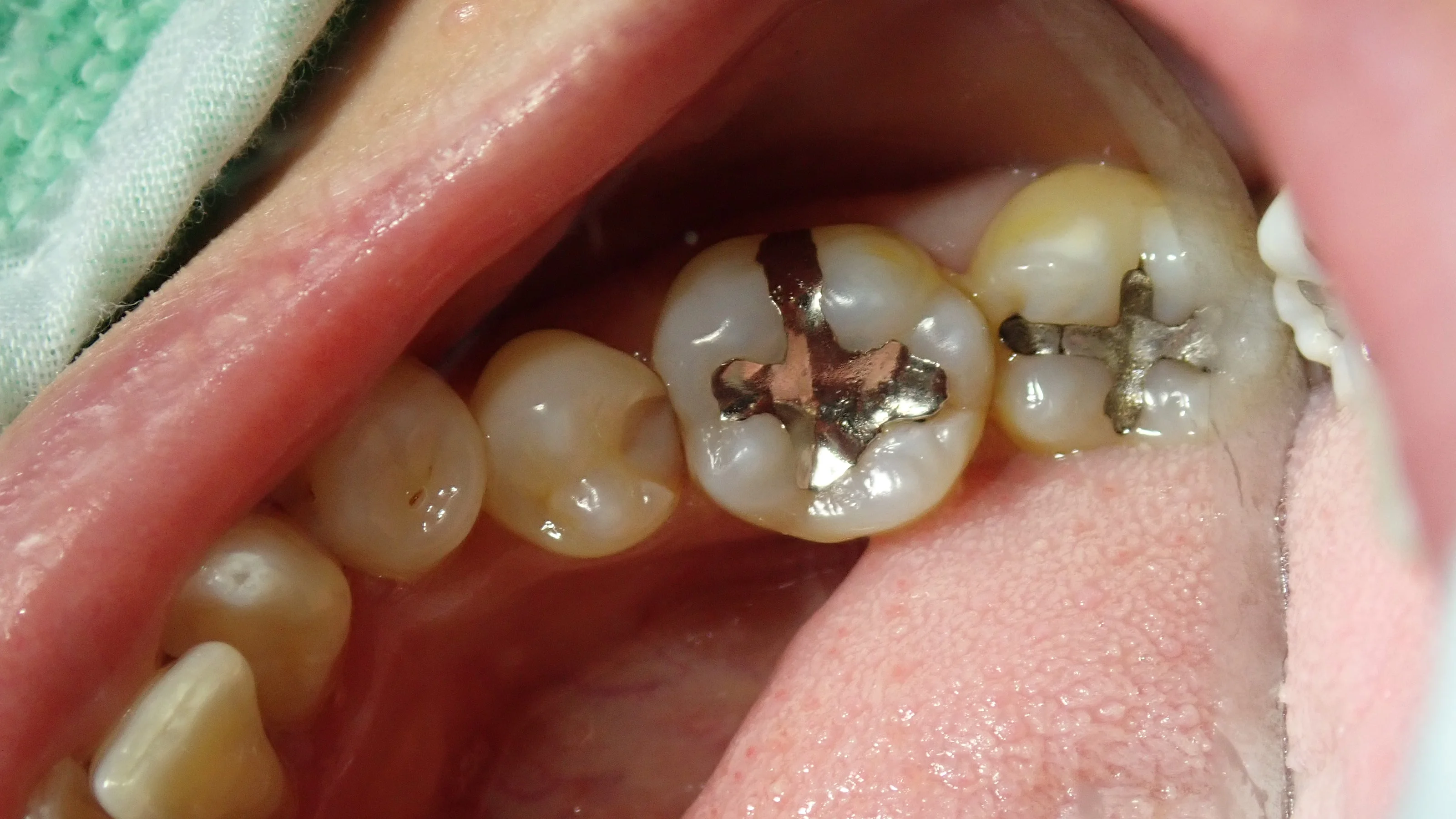 ブログ・お役立ち情報｜坂寄歯科医院（取手市藤代）