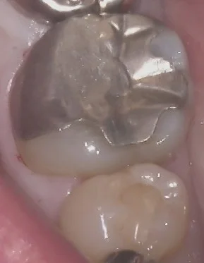 ブログ・お役立ち情報｜坂寄歯科医院（取手市藤代）