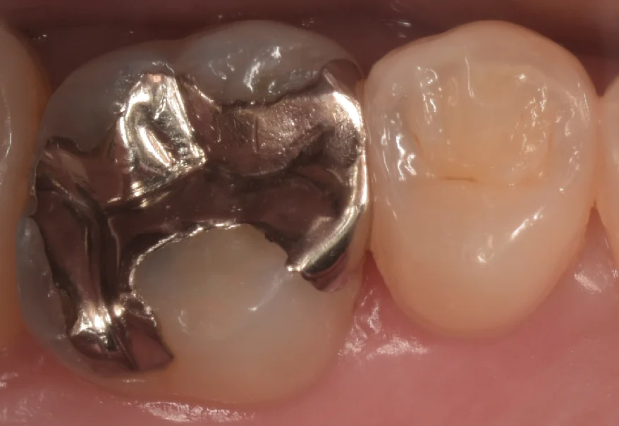 ブログ・お役立ち情報｜坂寄歯科医院（取手市藤代）