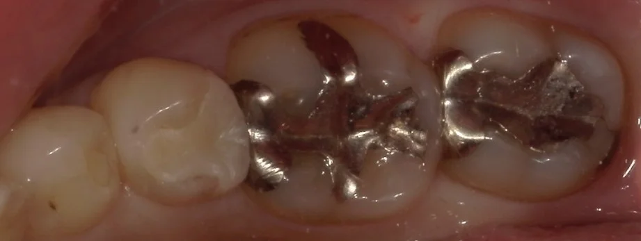 ブログ・お役立ち情報｜坂寄歯科医院（取手市藤代）