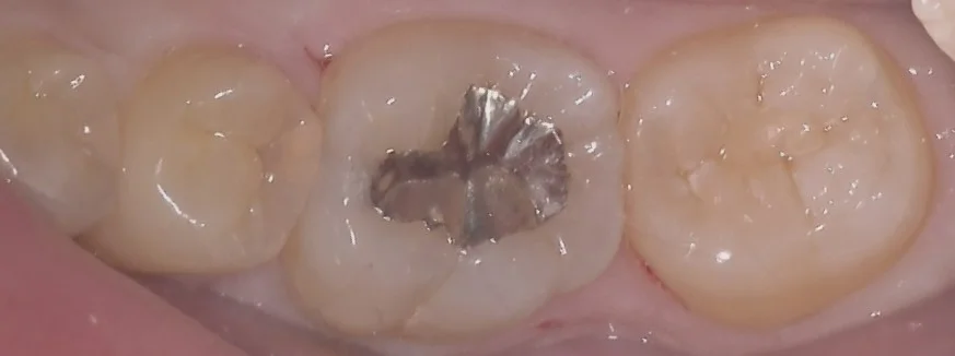 ブログ・お役立ち情報｜坂寄歯科医院（取手市藤代）