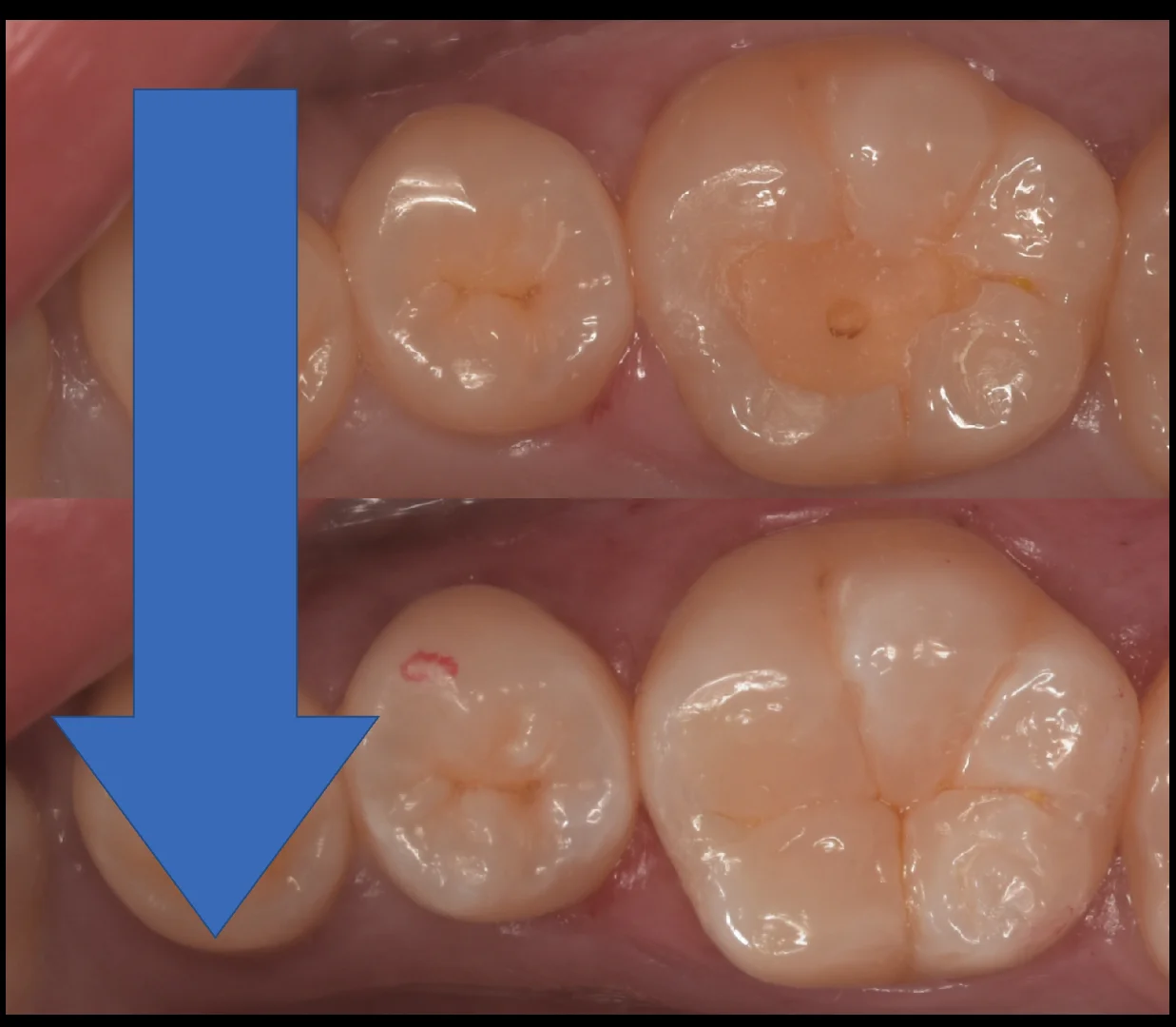 歯学部生をダイレクトで。｜坂寄歯科医院（取手市藤代） - 画像7