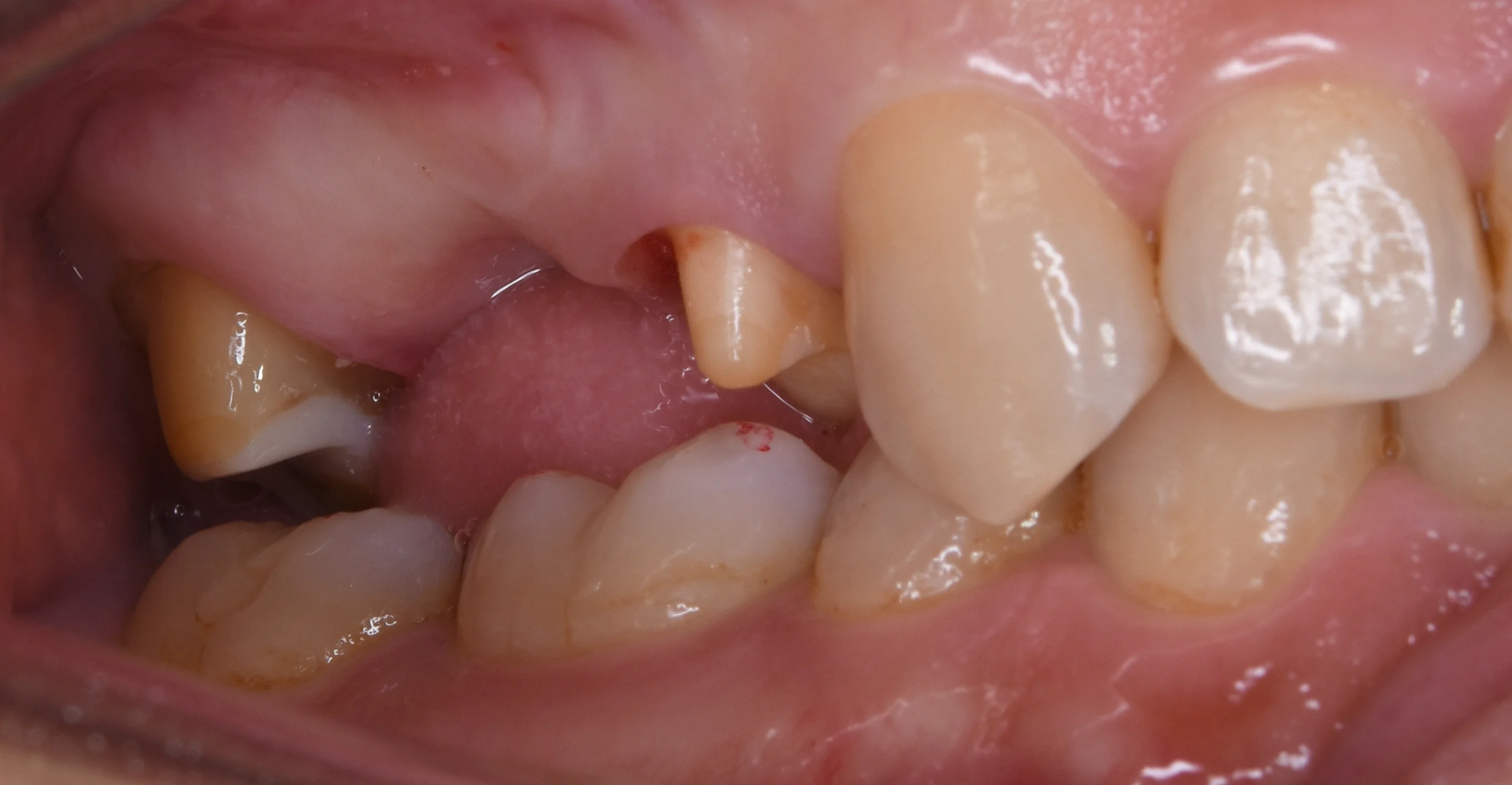 ブログ・お役立ち情報｜坂寄歯科医院（取手市藤代）