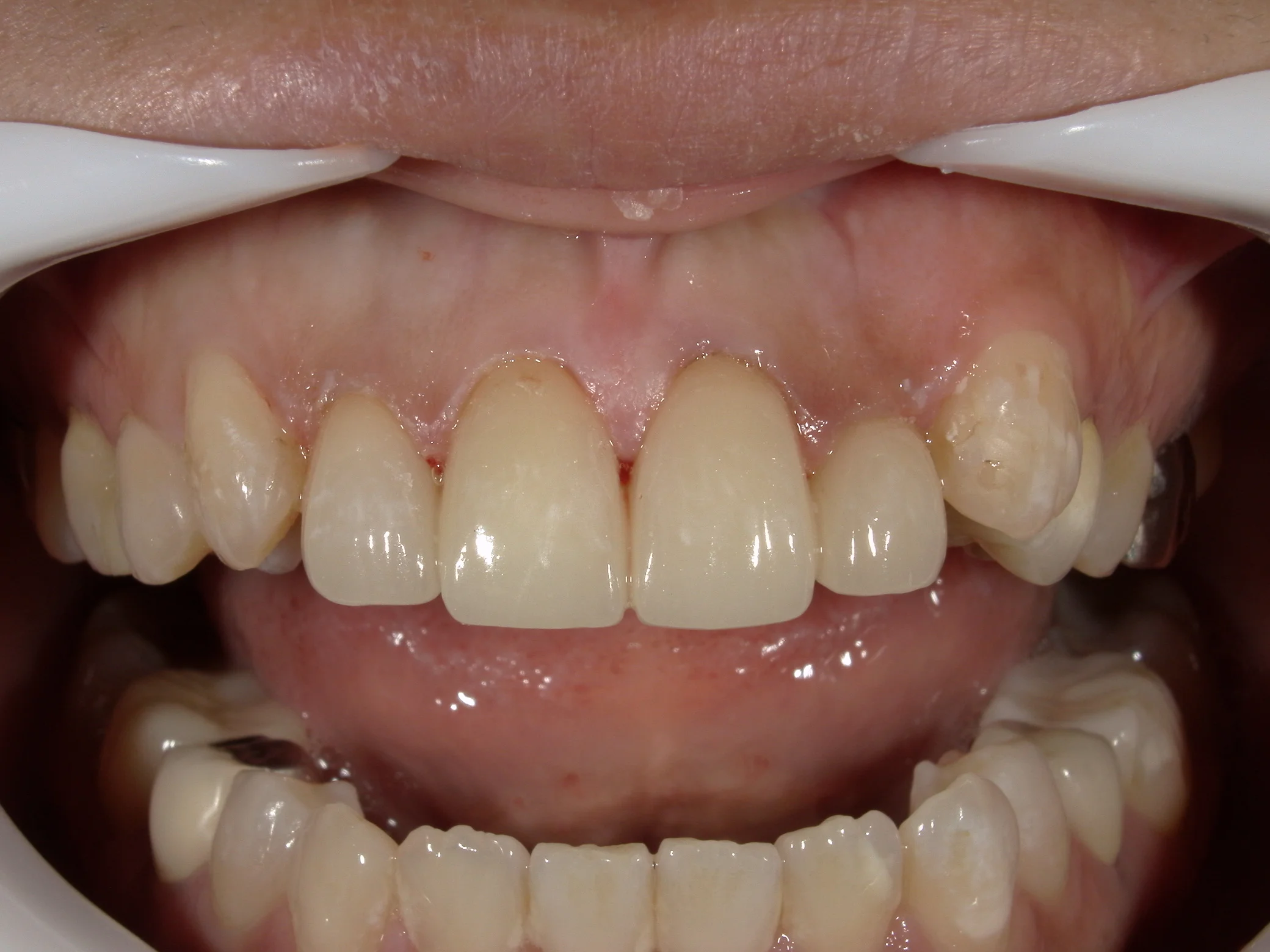 ブログ・お役立ち情報｜坂寄歯科医院（取手市藤代）