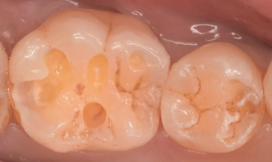 神奈川県からお越しの方|坂寄歯科医院(取手市藤代) - 画像4