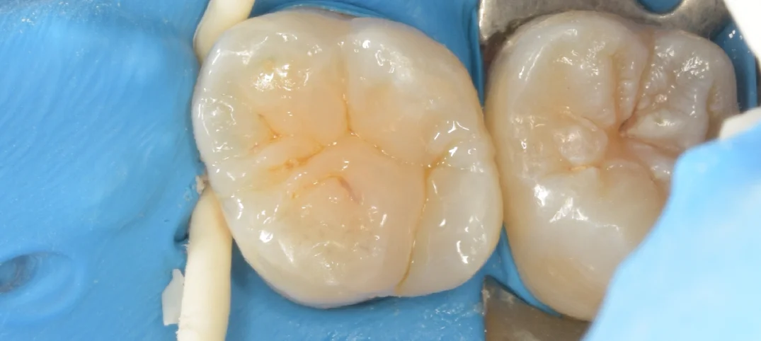 竜ヶ崎市からお越しの方。|坂寄歯科医院(取手市藤代) - 画像4