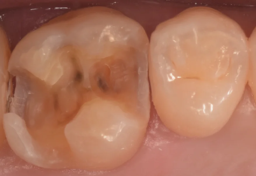 千葉県からお越しの方｜坂寄歯科医院（取手市藤代） - 画像3