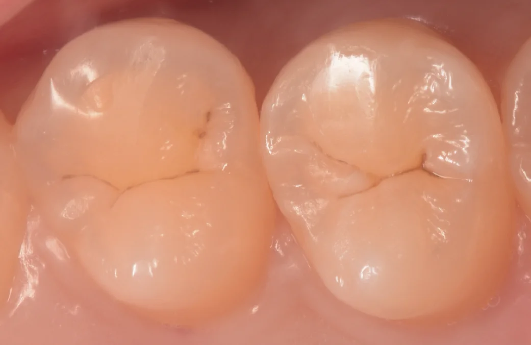 ブログ・お役立ち情報｜坂寄歯科医院（取手市藤代）