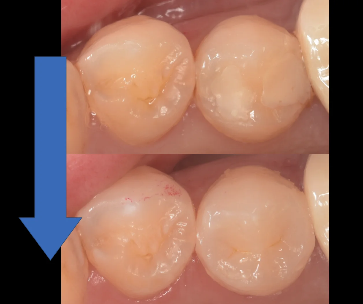 東京都からお越しの方｜坂寄歯科医院（取手市藤代） - 画像4