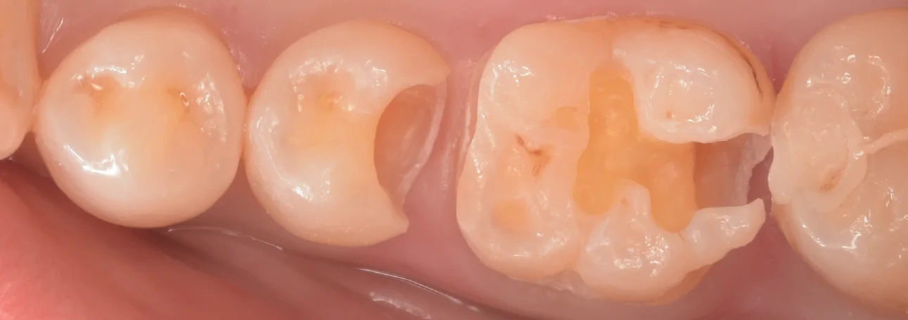 三鷹より来院された方｜坂寄歯科医院（取手市藤代） - 画像5