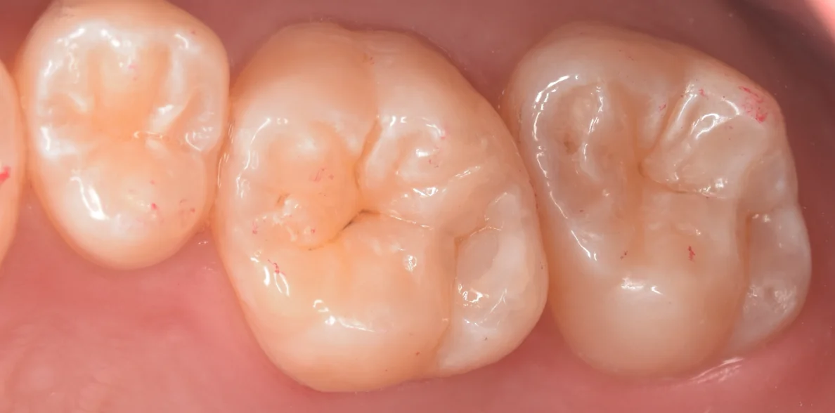 群馬からお越しの歯科医師の方。|坂寄歯科医院(取手市藤代) - 画像4