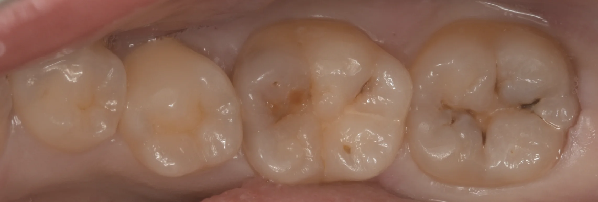 ブログ・お役立ち情報｜坂寄歯科医院（取手市藤代）