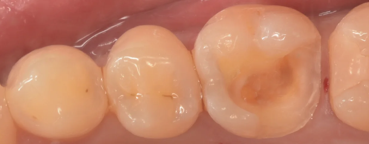 埼玉県からお越しの方|坂寄歯科医院(取手市藤代) - 画像2