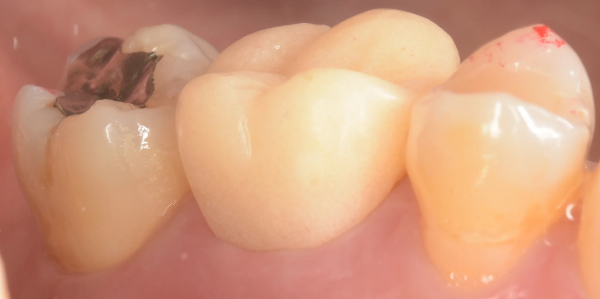 ブログ・お役立ち情報｜坂寄歯科医院（取手市藤代）