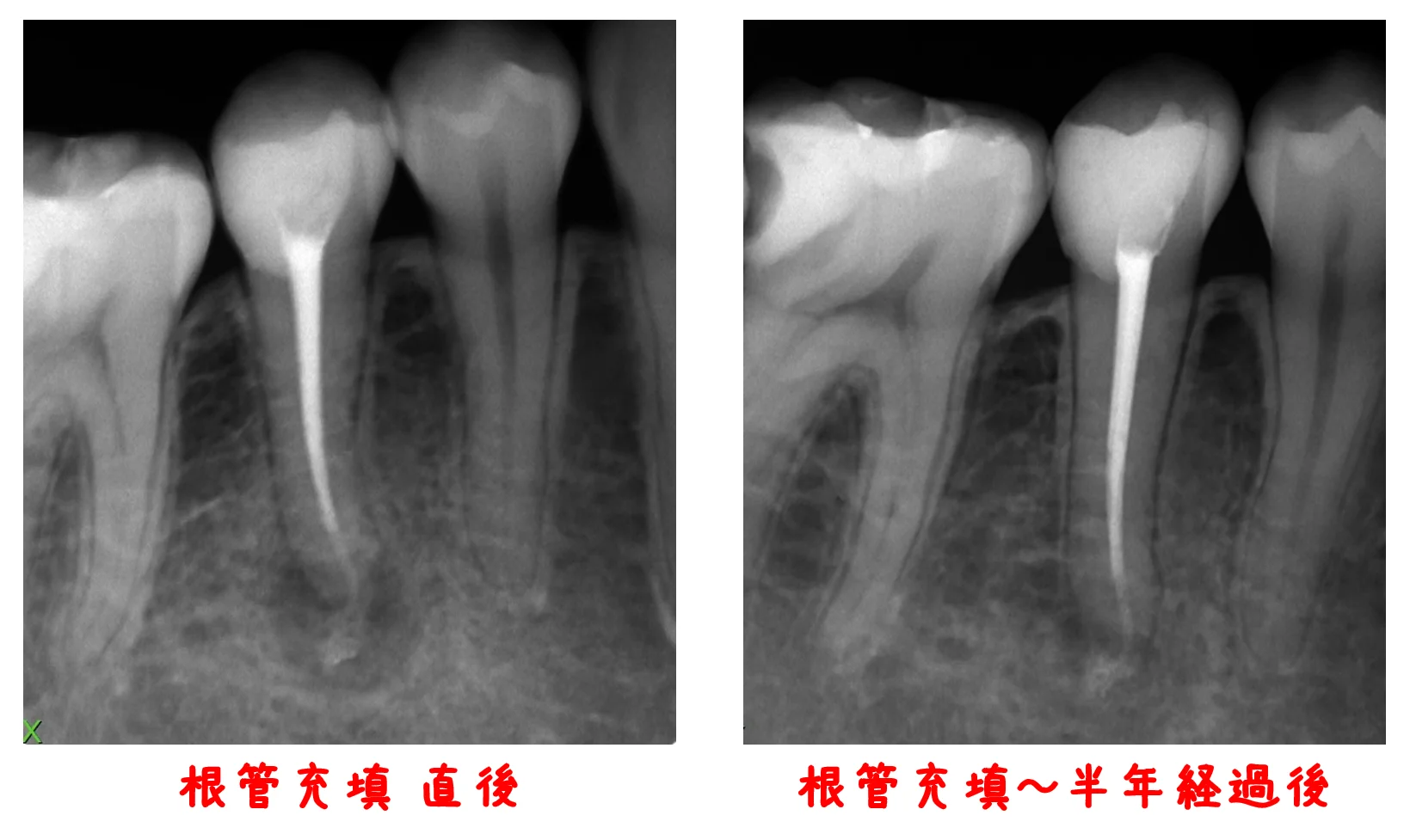 ブログ・お役立ち情報｜坂寄歯科医院（取手市藤代）