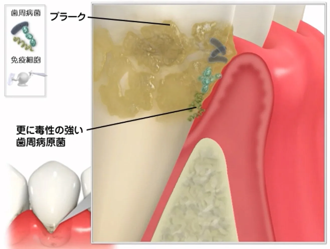ブログ・お役立ち情報｜坂寄歯科医院（取手市藤代）
