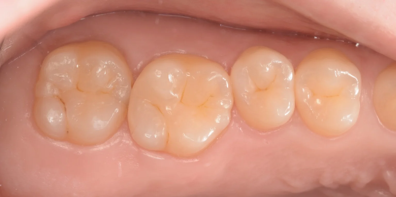 浦安からお越しの方。｜坂寄歯科医院（取手市藤代） - 画像3