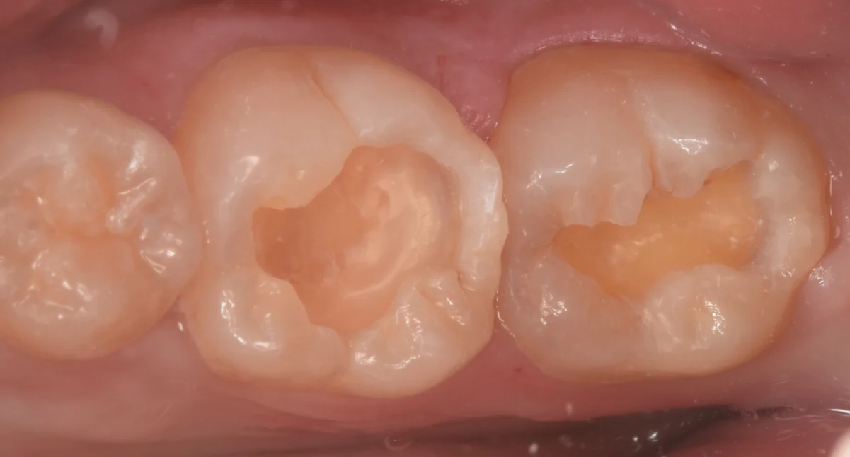 竜ヶ崎市からお越しの方。|坂寄歯科医院(取手市藤代) - 画像3