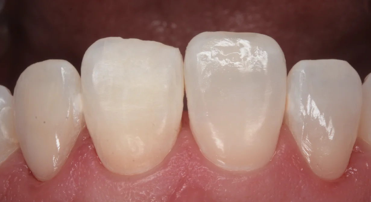 目黒からお越しの方｜坂寄歯科医院（取手市藤代） - 画像4