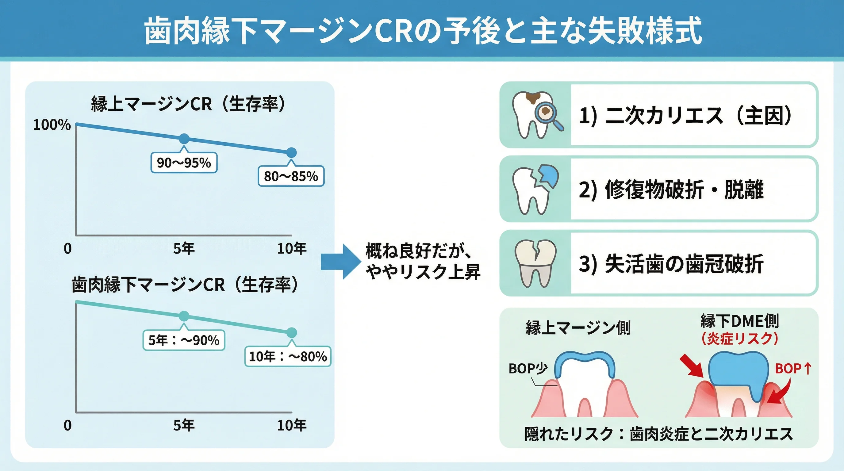縁上マージンCRと歯肉縁下マージンCRの5年・10年の生存率と、二次カリエス・修復物破折/脱離・失活歯の歯冠破折・歯肉炎リスクなど主な失敗様式を示したグラフとイラスト