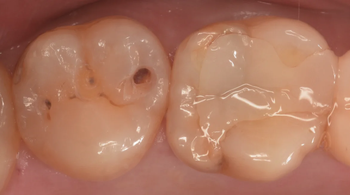 他県より来院された方。|坂寄歯科医院(取手市藤代) - 画像2