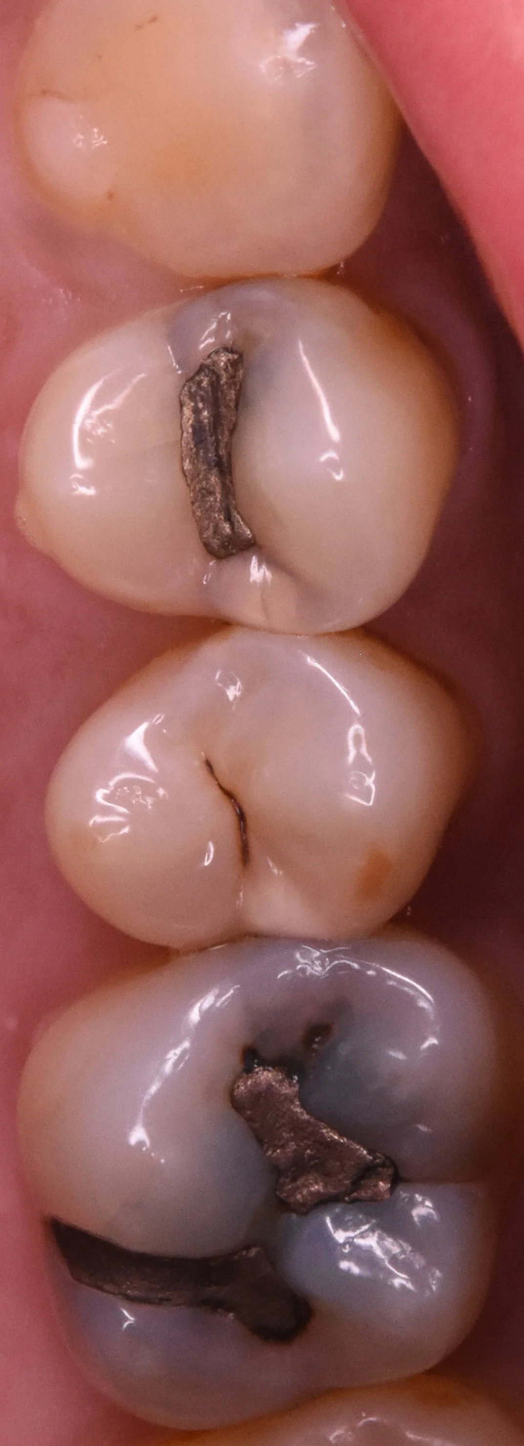 ブログ・お役立ち情報｜坂寄歯科医院（取手市藤代）