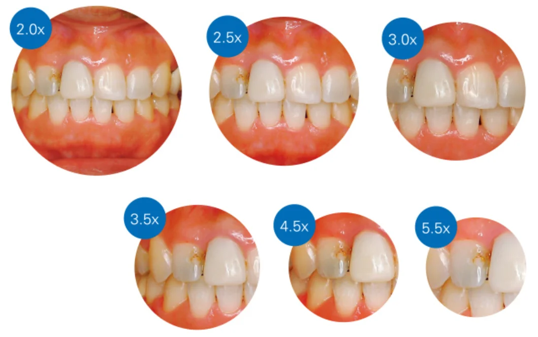 ブログ・お役立ち情報｜坂寄歯科医院（取手市藤代）