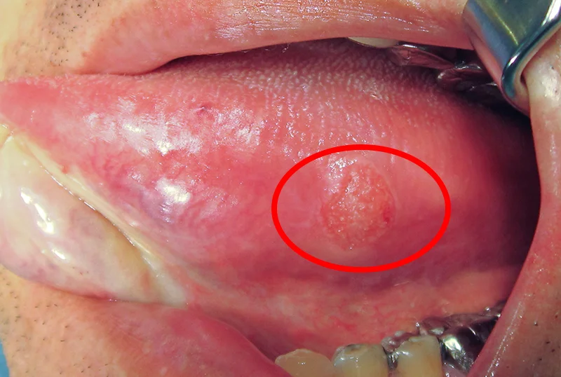 ブログ・お役立ち情報｜坂寄歯科医院（取手市藤代）