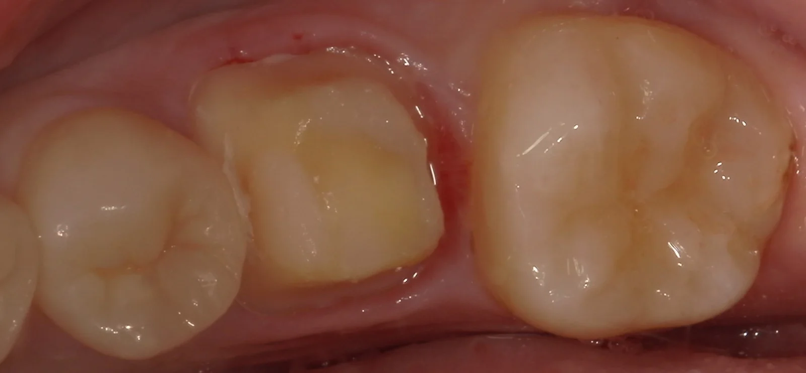 ブログ・お役立ち情報｜坂寄歯科医院（取手市藤代）