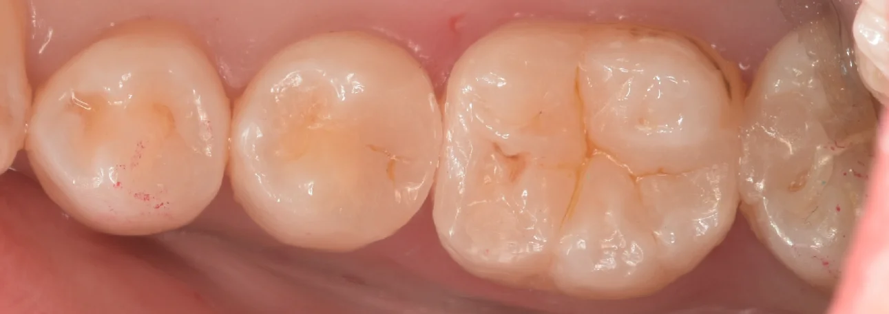 三鷹より来院された方｜坂寄歯科医院（取手市藤代） - 画像7