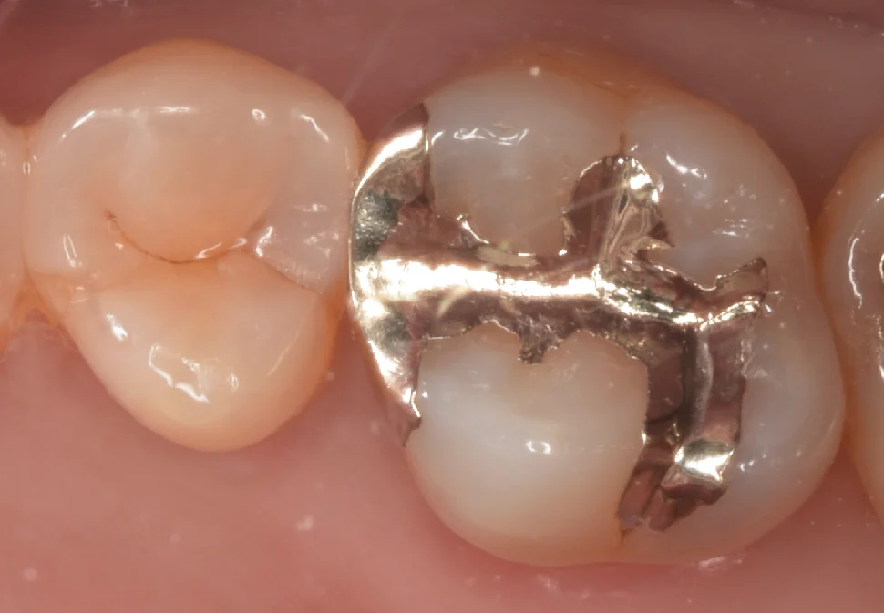 ブログ・お役立ち情報｜坂寄歯科医院（取手市藤代）