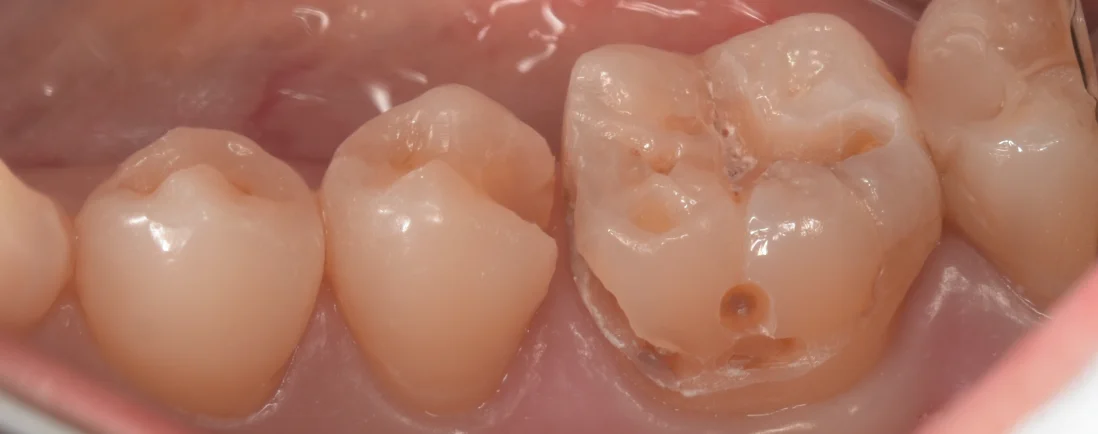 三鷹より来院された方｜坂寄歯科医院（取手市藤代） - 画像4